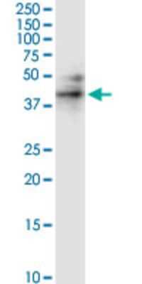 Western Blot: RPIP8 Antibody (1A8) [H00010900-M01]