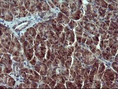 Immunohistochemistry: RPIP8 Antibody (OTI3C6) [NBP2-45638]