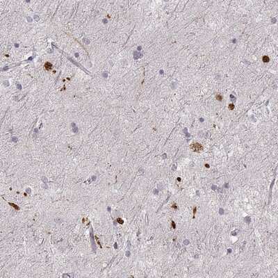 Immunohistochemistry: RPIP8 Antibody [NBP2-68906]