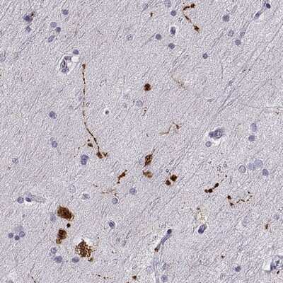 Immunohistochemistry-Paraffin: RPIP8 Antibody [NBP1-80855]