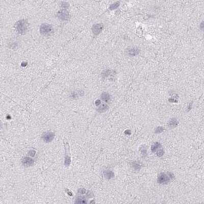 Immunohistochemistry-Paraffin: RPIP8 Antibody [NBP1-80855]