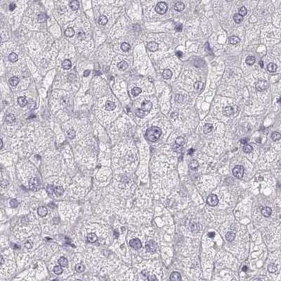 Immunohistochemistry-Paraffin: RPIP8 Antibody [NBP1-80855]