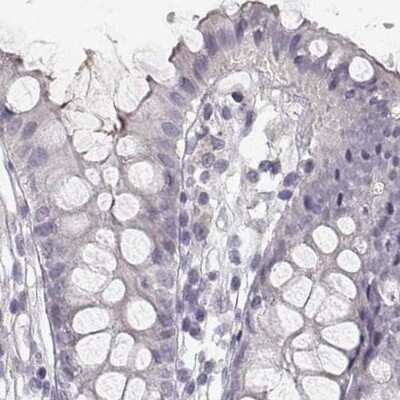 Immunohistochemistry-Paraffin: RPIP8 Antibody [NBP2-68906]