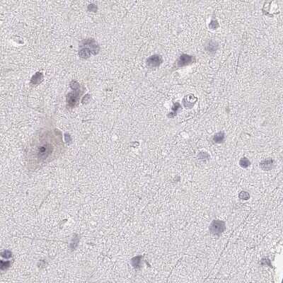 Immunohistochemistry-Paraffin: RPIP8 Antibody [NBP2-68906]