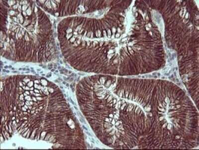Immunohistochemistry: RPIP8 Antibody (OTI3C6) - Azide and BSA Free [NBP2-73943]