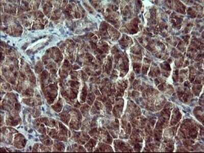 Immunohistochemistry: RPIP8 Antibody (OTI3C6) - Azide and BSA Free [NBP2-73943]