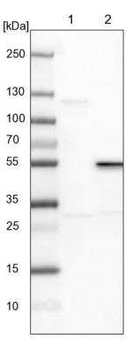 Western Blot: RPIP8 Antibody [NBP1-80855]