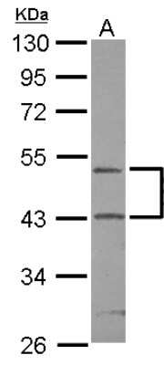 Western Blot: RPIP8 Antibody [NBP2-20209]