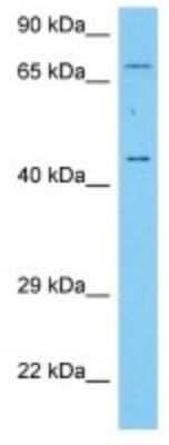 Western Blot: RPIP8 Antibody [NBP3-10196]