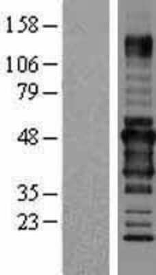 Western Blot: RPIP8 Overexpression Lysate [NBL1-15623]