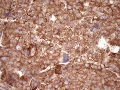 Immunohistochemistry: RPL10 Antibody (OTI6B11) [NBP2-45628]