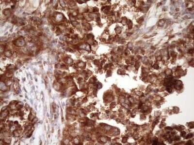 Immunohistochemistry: RPL10 Antibody (OTI6B11) [NBP2-45628]