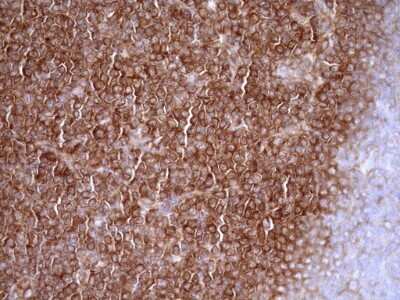 Immunohistochemistry: RPL10 Antibody (OTI6B11) [NBP2-45628]