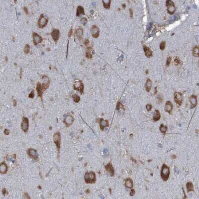 Immunohistochemistry-Paraffin: RPL10 Antibody [NBP1-84037]