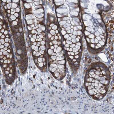 Immunohistochemistry-Paraffin: RPL10 Antibody [NBP1-84037]