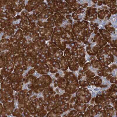 Immunohistochemistry-Paraffin: RPL10 Antibody [NBP1-84037]