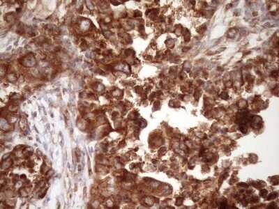 Immunohistochemistry: RPL10 Antibody (OTI6B11) - Azide and BSA Free [NBP2-73944]