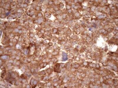 Immunohistochemistry: RPL10 Antibody (OTI6B11) - Azide and BSA Free [NBP2-73944]