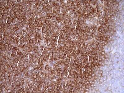 Immunohistochemistry: RPL10 Antibody (OTI6B11) - Azide and BSA Free [NBP2-73944]