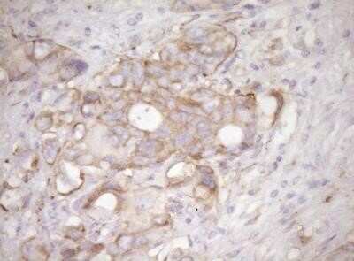 Immunohistochemistry: RPL10 Antibody (OTI6B11) - Azide and BSA Free [NBP2-73944]