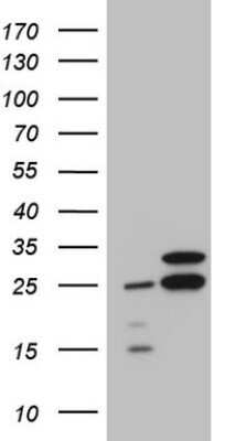 Western Blot: RPL10 Antibody (OTI6B11)Azide and BSA Free [NBP2-73944]