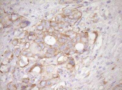 Immunohistochemistry: RPL10 Antibody (OTI6B11) [NBP2-45628]