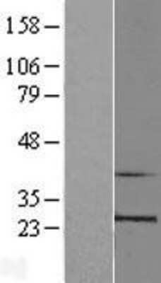 Western Blot: RPL10 Overexpression Lysate [NBL1-15499]