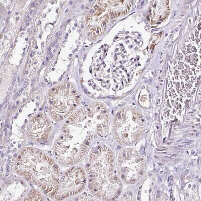 Immunohistochemistry-Paraffin: RPL10A Antibody [NBP2-47298]