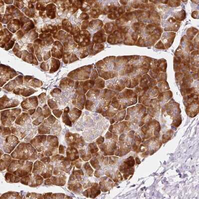 Immunohistochemistry-Paraffin: RPL10A Antibody [NBP2-47298]