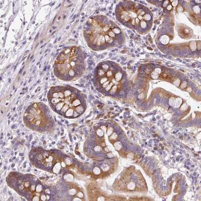 Immunohistochemistry-Paraffin: RPL10A Antibody [NBP2-47298]