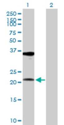 Western Blot: RPL10A Antibody [H00004736-D01P]