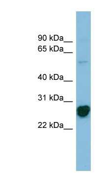 Western Blot: RPL10A Antibody [NBP1-56386]