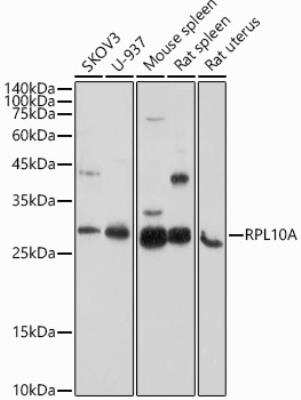 Western Blot: RPL10A AntibodyBSA Free [NBP2-93591]