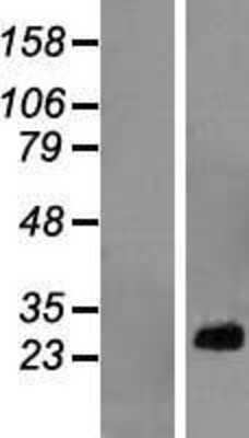 Western Blot: RPL10A Overexpression Lysate [NBL1-15500]