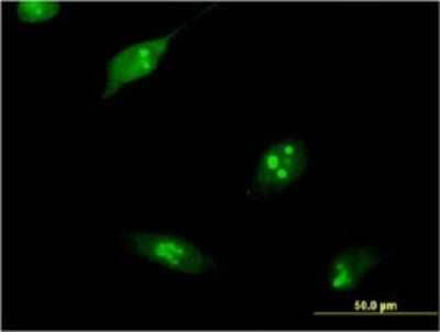 Immunocytochemistry/ Immunofluorescence: RPL10L Antibody (1E9) [H00140801-M01]