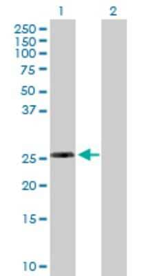 Western Blot: RPL10L Antibody [H00140801-B01P]