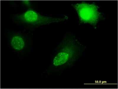 Immunocytochemistry/ Immunofluorescence: RPL11 Antibody (2A1) [H00006135-M04]