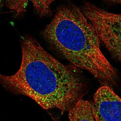 Immunocytochemistry/ Immunofluorescence: RPL11 Antibody [NBP2-57808]