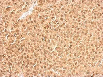 Immunohistochemistry-Paraffin: RPL11 Antibody [NBP2-20210]