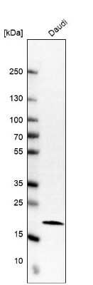 Western Blot: RPL11 Antibody [NBP1-81333]