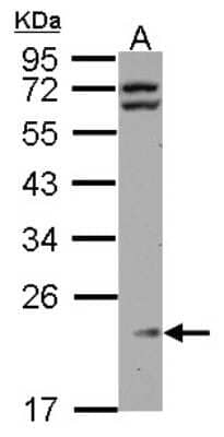 Western Blot: RPL11 Antibody [NBP2-20210]