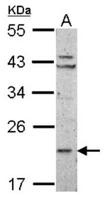 Western Blot: RPL11 Antibody [NBP2-20210]