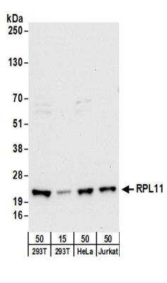 Western Blot: RPL11 Antibody [NBP2-22283]
