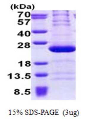 SDS-PAGE: Recombinant Human RPL11 His Protein [NBP2-23417]