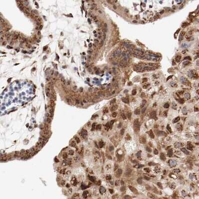 Immunohistochemistry-Paraffin: RPL12 Antibody [NBP1-82857]