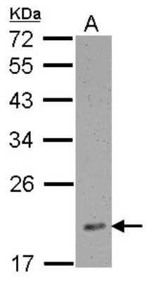 Western Blot: RPL12 Antibody [NBP2-20211]