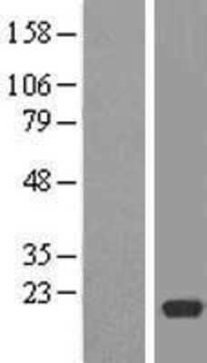 Western Blot: RPL12 Overexpression Lysate [NBP2-08989]