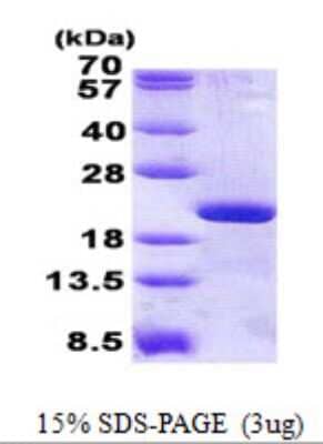 SDS-PAGE: Recombinant Human RPL12 His Protein [NBP2-23418]