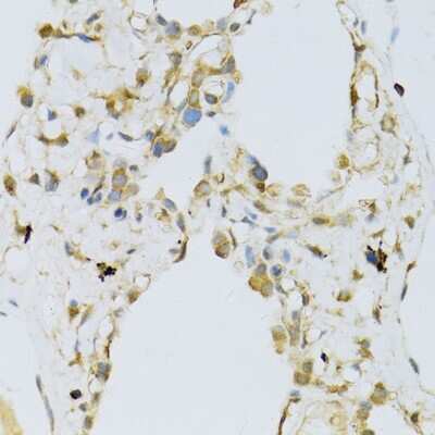 Immunohistochemistry-Paraffin: RPL13 Antibody - BSA Free [NBP2-94875]