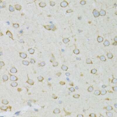 Immunohistochemistry-Paraffin: RPL13 Antibody - BSA Free [NBP2-94875]